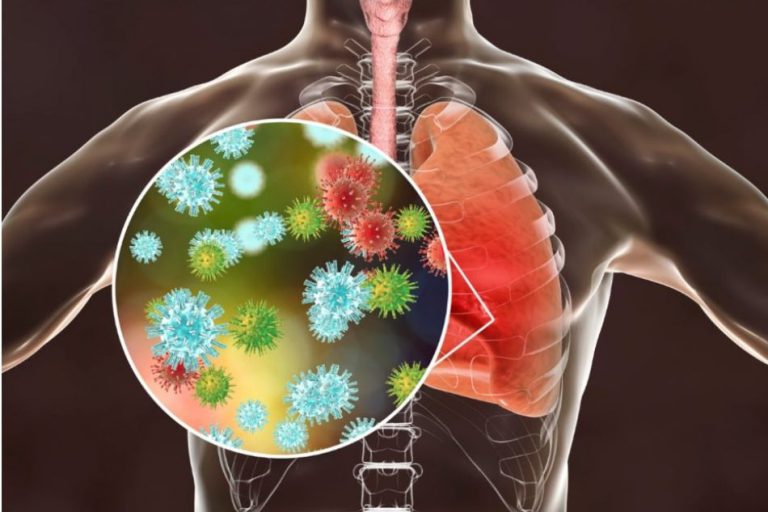 Innovation in healing Covid-19 and post-Covid-19