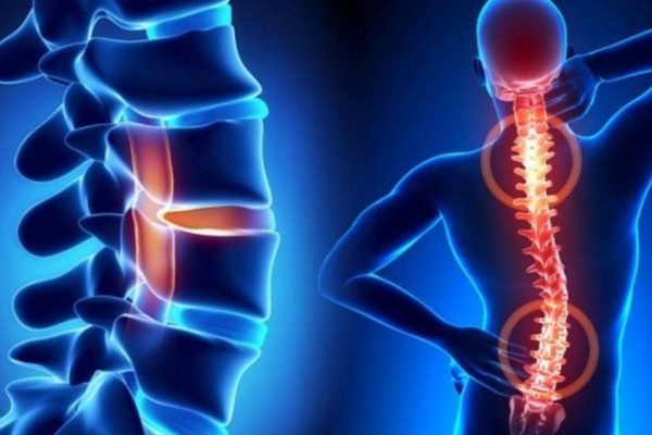 Innovation in treatment and prevention of musculoskeletal disease