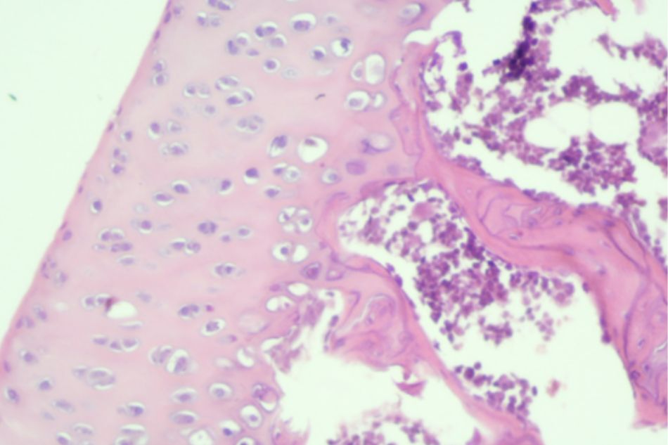 Knee joint sample in Group I (rat no.2)