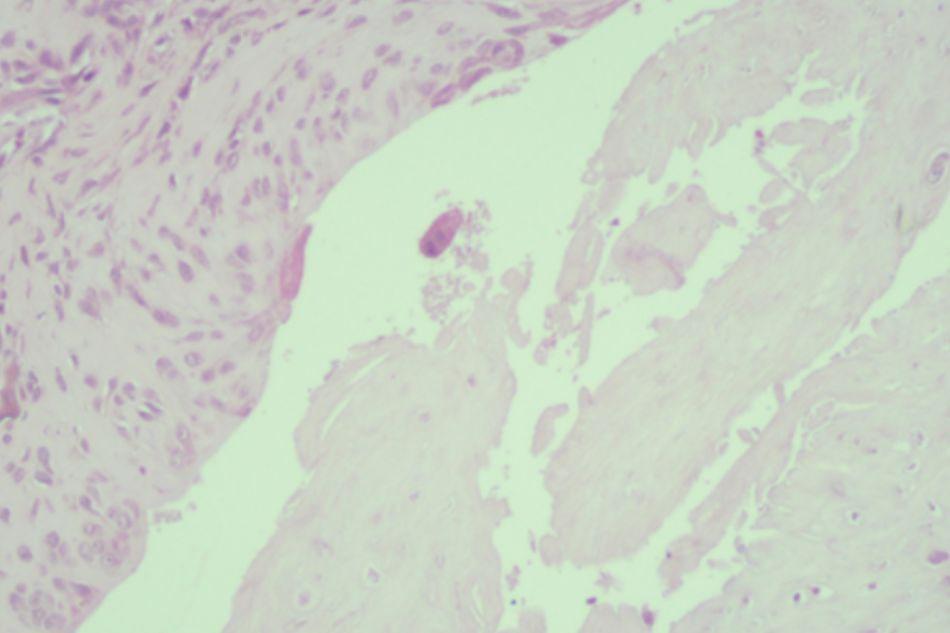 Knee joint sample in Group II (rat no.11)