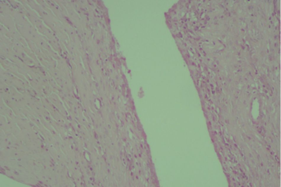 Knee joint sample in Group III (rat no.22)