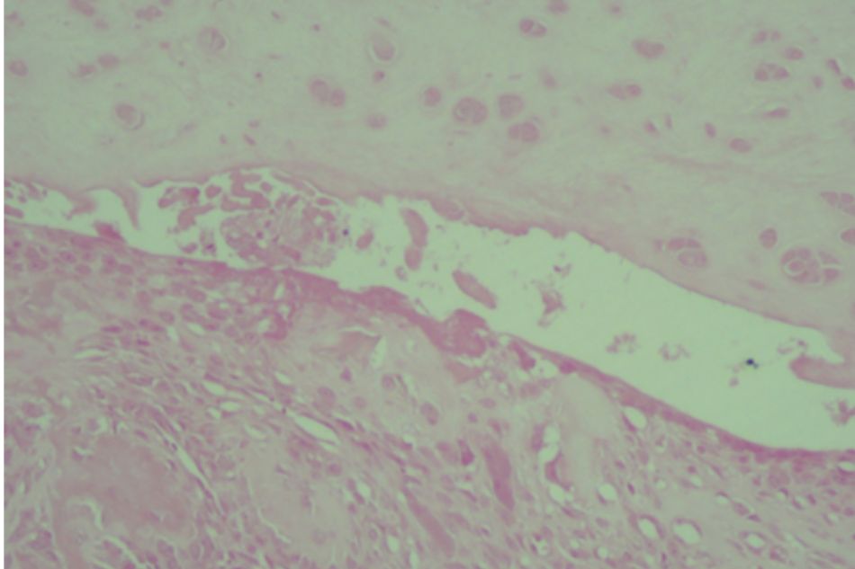 Knee joint sample in Group III (rat no.21)