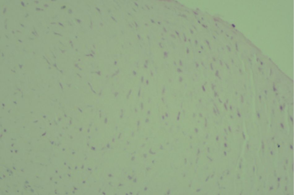 Knee joint sample in Group IV (rat no.42)