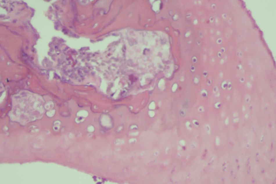 Knee joint sample in Group V (rat no.32