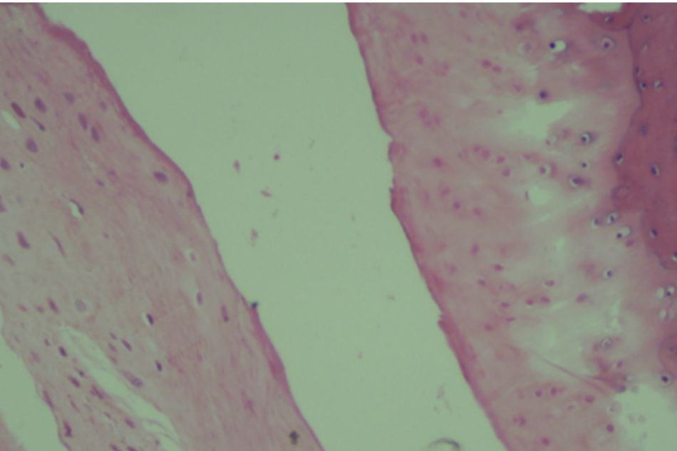 Knee joint sample in Group V (rat no.31)